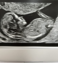 Can anyone guess the gender?