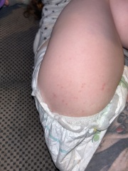 Does anyone recognise this rash/spots?
