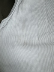 Weird grey stains on white clothing