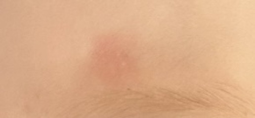 Random red patches