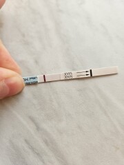 Do I have line eyes?