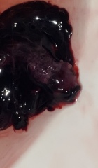 Help, possible miscarriage???