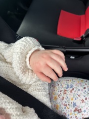 Weird spots that calm down and flair up