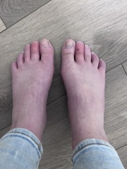 The doctor doesn't know what's wrong with my foot