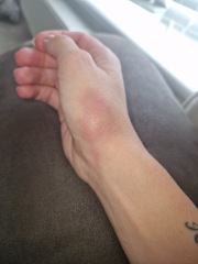 What could this mark on my hand be?