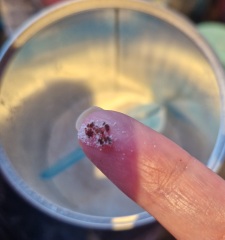 Particles found in neocate