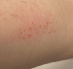 Advice or similar situations please