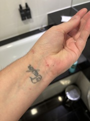 What is this rash :(