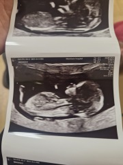 Scan what do u think boy or girl