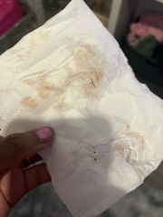 Is this implantation bleeding ?