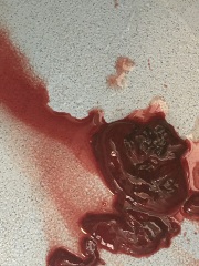 Tw (photo) Massive tissue/blood clot.. vaginal cast?