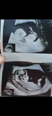 Guess the gender !