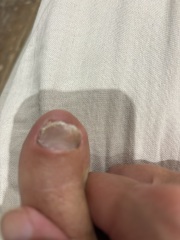 **warning gross feet pic **