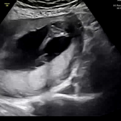 Due February 2025 - Thread 3