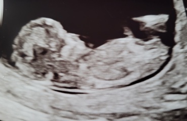 Boy or girl? 💙💗