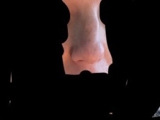 Any ENT surgeons? Wonky nose? Fix
