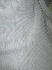 Weird grey stains on white clothing