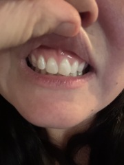 Teeth