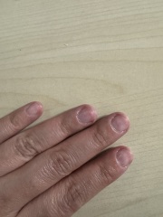 To Ask How To Stop Biting Nails