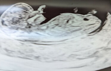 Guess my baby's gender