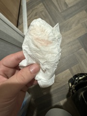 Implantation bleeding 13 dpo