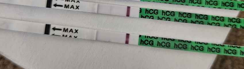 9DPO