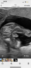 16 week gender scan