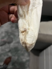 Is this implantation bleeding ?