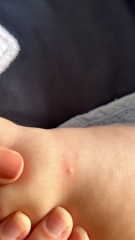 What could these spots be?