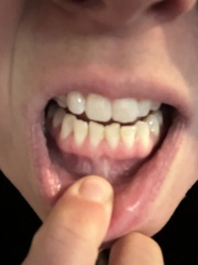 Teeth