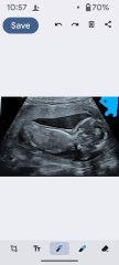 Gender of scan images