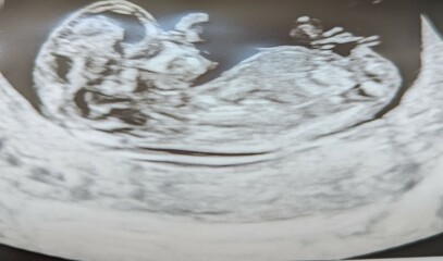 Guess my baby's gender