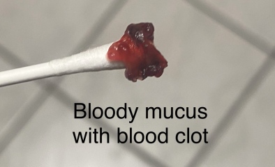 Any idea what this could be...GROSS PIC INCLUDED