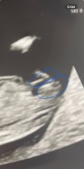 Nub theory - can you see it?