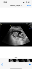 16 week gender reveal images