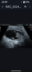 Gender of scan images