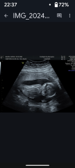 Gender of scan images