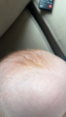 Would you say my baby is ginger ?