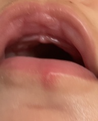 Is this a cold sore on my baby?