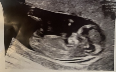 Boy or girl