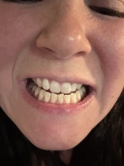 Teeth