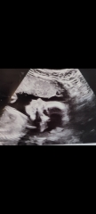 Guess the gender !