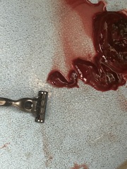 Tw (photo) Massive tissue/blood clot.. vaginal cast?