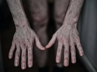 Ukraine Invasion: Part 51