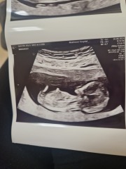 Scan what do u think boy or girl