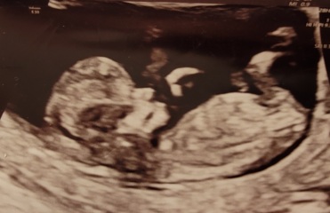 Boy or girl? 💙💗
