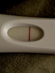 do I have line eyes?