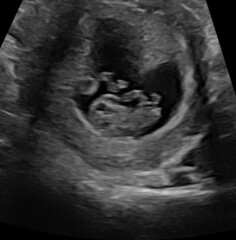 Any gender guesses? :)