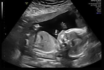 Due February 2025 - Thread 3