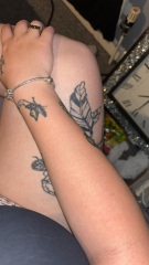 Rash and itch